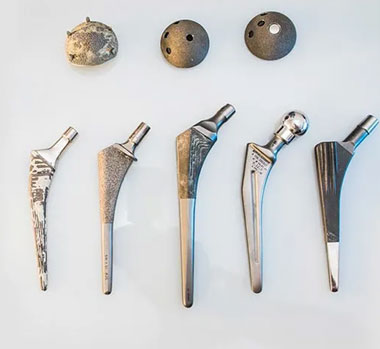 Orthopaedic Implants